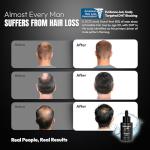 Truth Guy RU58841 10% Hair Serum for Men