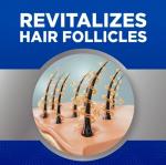 Kirkland Minoxidil 5% Hair Regrowth Treatment for Men