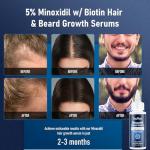 5% Minoxidil Hair Growth Serum with Biotin