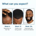 Rosemary Growth Serum for Thicker Hair & Beard