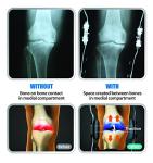 Pro Decompression Knee Brace for Arthritis Relief