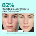 HUM Daily Cleanse Acne Support Supplements, 60 Capsules