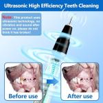 Ultrasonic Pet Teeth Cleaner for Dogs and Cats