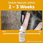 Salmon Oil for Dogs - Premium Fish Oil for Skin and Coat Health - Omega 3 Supplement - Supports Itchy Skin - 8 oz Liquid - Norwegian Dog Salmon Oil - Essential Dog Supplement