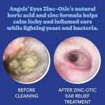 Angels’ Eyes Ear Relief Treatment for Dogs and Cats