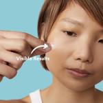 Skin Choice Acne Spot Patches – Clear Breakouts Fast