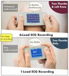 EMAY 6L Portable ECG Monitor with Heart Rate Tracking
