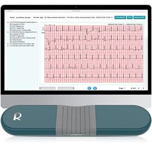 Livenpace Portable 24-Hour Heart Health Monitor