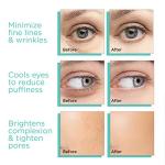 MonétBeauty Ice Globes for Facial Tightening and Glow