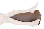 Skwoosh Inflatable Leg Elevation Pillow for Recovery