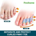 Povihome 10 Pack Pinky Toe Separators and Protectors