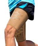Sparthos Thigh Compression Sleeves for Recovery