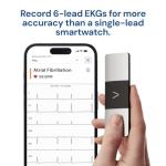 AliveCor KardiaMobile 6-Lead Heart EKG Monitor