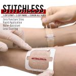 EverLit Surgical Zip-Stitch Wound Closure Kit