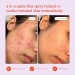 Tower 28 SOS Facial Spray for Redness Relief