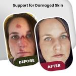 Brave Soldier Antiseptic Ointment for Fast Healing