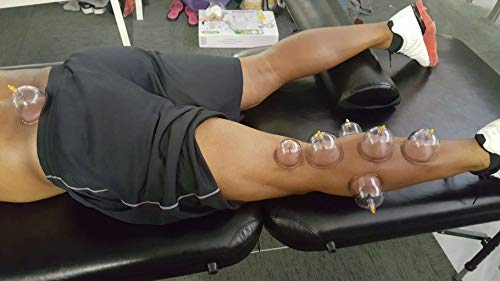 Cupping Set Professional Chinese Acupoint Cupping Therapy Sets, Suction Hijama Cupping Set with Vacuum Magnetic Pump Cellulite Cupping Massage Kit 22-Cup by MUCHOO