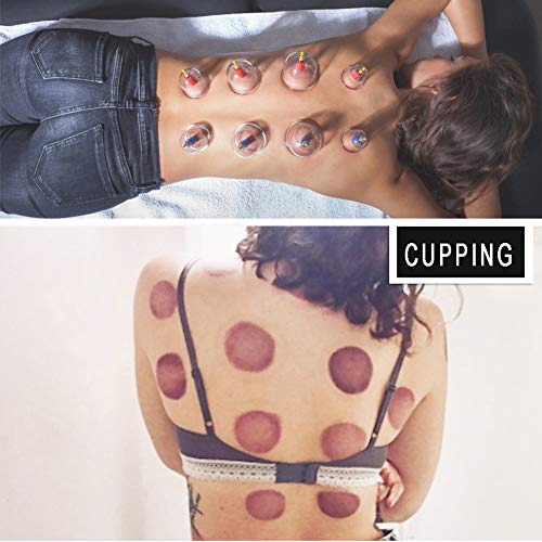 Cupping Set Professional Chinese Acupoint Cupping Therapy Sets, Suction Hijama Cupping Set with Vacuum Magnetic Pump Cellulite Cupping Massage Kit 22-Cup by MUCHOO