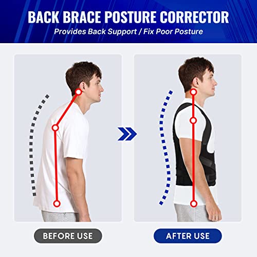 Potensgo Posture Corrector for Men and Women,Fully Adjustable Back Brace Posture Corrector,Lightweight and Breathable Back Support and Scoliosis Back Brace for Posture Correction (Medium) by Silvanes LLC