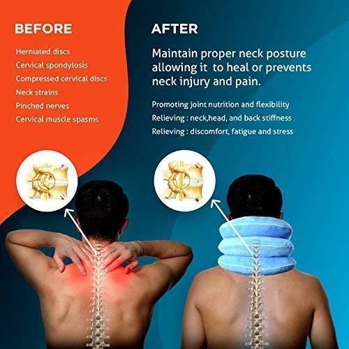 Cervical Neck Traction Device by NeckFix for Instant Neck Pain Relief - Adjustable Neck Stretcher Collar for Home Traction Spine Alignment [Model 2019] + Bonus (12-17 inch) from Fix Company