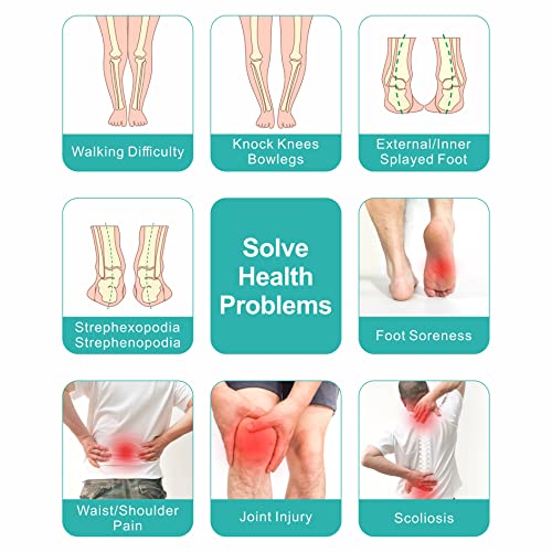 rorpove Plantar Fasciitis Relief Arch Support Insoles for Women and Men Flat Foot and High Arch Support Shoe Inserts & Insoles Relieve Back Hip Leg Knee Waist and Foot Pain Improve Body Balance from rorpove