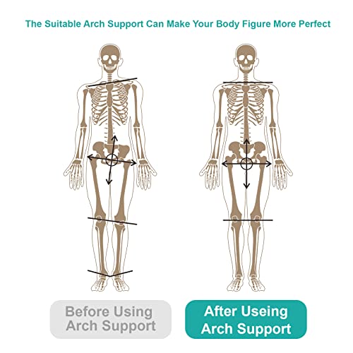 rorpove Plantar Fasciitis Relief Arch Support Insoles for Women and Men Flat Foot and High Arch Support Shoe Inserts & Insoles Relieve Back Hip Leg Knee Waist and Foot Pain Improve Body Balance from rorpove