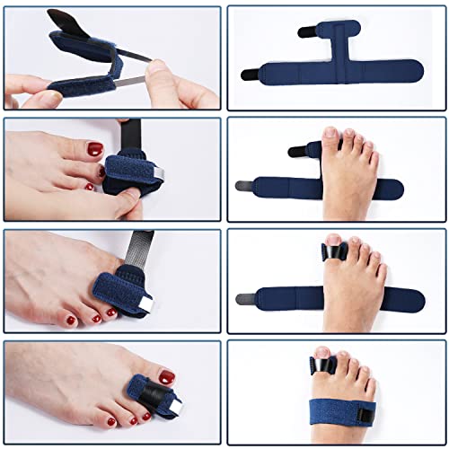 2pcs Toe Splints for Straightening, Dark Blue Toe Brace for Broken Toe straighteners for Hammer Toes Crooked Toes Bent Toes (2 Styles) from AIEX