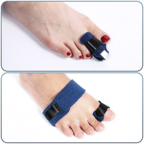 2pcs Toe Splints for Straightening, Dark Blue Toe Brace for Broken Toe straighteners for Hammer Toes Crooked Toes Bent Toes (2 Styles) from AIEX