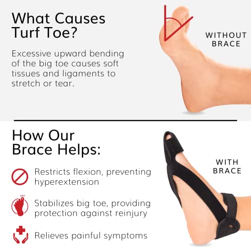 BraceAbility Turf Toe Brace - New, Adjustable Medical-Grade Foot Orthotic for Sprained and Hyperextended Big Toe Injury Treatment and Pain Relief - Perfect Splint, Plate, and Taping Alternative (L) by BraceAbility