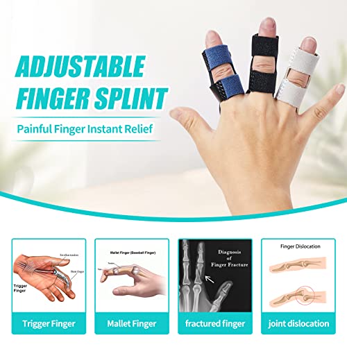 Finger Splints (3PCS), Finger Support Braces, Adjustable Finger Protectors Sleeves for Trigger Finger, Mallet Finger, Broken Finger, Arthritis, Knuckle Immobilization, Straightening. Best Fit for Index Middle Ring Finger from KVMDAZ