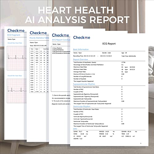 Checkme ER1 24-Hour Heart Health Monitor | Personal Holter with AI-Enabled Analysis to detect 16 Irregular Rhythms | Software Compatible with Windows and macOS from Checkme