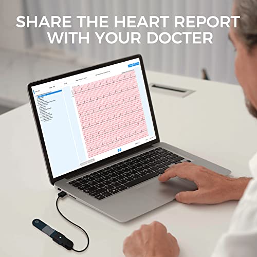 Checkme ER1 24-Hour Heart Health Monitor | Personal Holter with AI-Enabled Analysis to detect 16 Irregular Rhythms | Software Compatible with Windows and macOS from Checkme