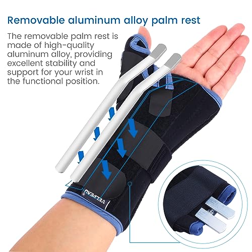 VELPEAU Wrist Brace with Thumb Spica Splint for De Quervain's Tenosynovitis, Carpal Tunnel Pain, Stabilizer for Tendonitis, Arthritis, Sprains & Fracture Forearm Support Cast (Regular, Right Hand-M) by 