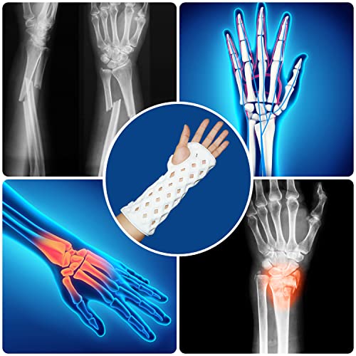 CHAMPK Wrist Brace, Resting hand splint. Suitable for Correction Left/Right hand sports fractures and post operative rehabilitation Fixed. New medical products. (Small by 