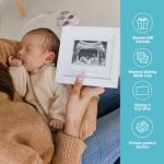 Pearhead Love at First Sight Sonogram Picture Frame, Baby Ultrasound Photo Frame, Baby Nursery DÃ©cor, White from Pearhead