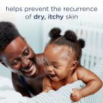 Baby Dove Soothing-Cream To Soothe Delicate Baby Skin Eczema Care No Artificial Perfume or Color, Paraben Free, Phthalate Free 5.1 oz by Unilever