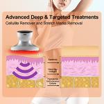 CENXIGO Cellulite Remover Body Massager for Women Belly Arms Thigh Hip Leg from Cenxigo