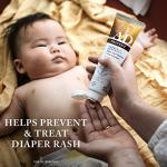 A+D Original Diaper Rash Ointment, Skin Protectant With Lanolin and Petrolatum, (Packaging May Vary) Cream 16 Ounce (Pack of 1) from A&D