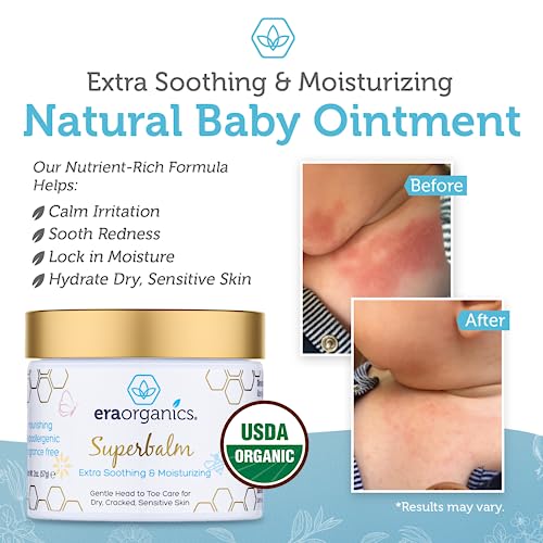 Era Organics Healing Ointment for Babies - USDA Certified Organic Natural Gentle Moisturizer for Sensitive Skin Prone To Baby Eczema, Cradle Cap (Infant Seborrheic Dermatitis), Rashes, Hives & More from Era Organics