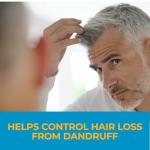 Nizoral Anti-Dandruff Shampoo 1% Ketoconazole, Fresh Scent