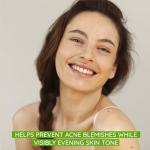 Aveeno Positively Radiant Acne Face Moisturizer