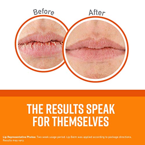 O'Keeffe's Unscented Lip Repair Lip Balm for Dry, Cracked Lips, Stick, (Pack of 10)