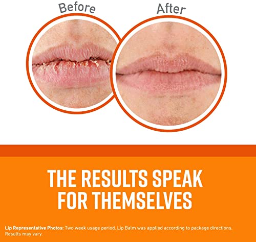 O'Keeffe's Unscented Lip Repair Lip Balm for Dry, Cracked Lips, Stick, (Pack of 5)