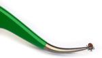 TickCheck Premium Tick Removal Kit with Tweezers