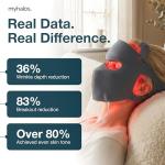 myhalos® Red Light Therapy Face Mask - Medical-Grade LED Light Therapy Device with Nir-Infrared (1072 nm), Red (633 nm) & Blue (460 nm) Light - Anti-Aging Skin Treatment for Wrinkles & Fine Lines