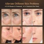 MEGELIN 7 Colors Led Light Therapy Facial Mask, Face Light Therapy Mask for Face, Reduce Wrinkles Smooth Skin, Infrared Light Skin Rejuvenation(White)