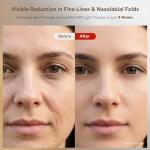 Red Light Therapy for Face, Red, Blue and Near-Infrared Light Therapy Mask for Face, Anti-Wrinkles & Facial Skincare, Portable & Rechargeable, LED Face Mask Light Therapy for Fine Lines and Blemishes.