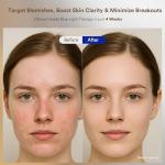 Red Light Therapy for Face, Red, Blue and Near-Infrared Light Therapy Mask for Face, Anti-Wrinkles & Facial Skincare, Portable & Rechargeable, LED Face Mask Light Therapy for Fine Lines and Blemishes.