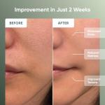 Nanoleaf FDA-Cleared LED Light Therapy Face Mask with 7 Treatment Modes - Professional Red & Blue Light with NIR Facial Device for Anti-Aging - 432 LEDs, Rechargeable