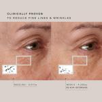 HigherDOSE Red Light Face Mask - FDA Cleared LED Red Light Therapy for Face with Near Infrared Technology - At-Home Facial Device to Improve Fine Lines, Wrinkles, Hydration & Redness for Glass Skin